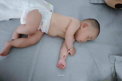 新疆六个月宝宝眼睛散光